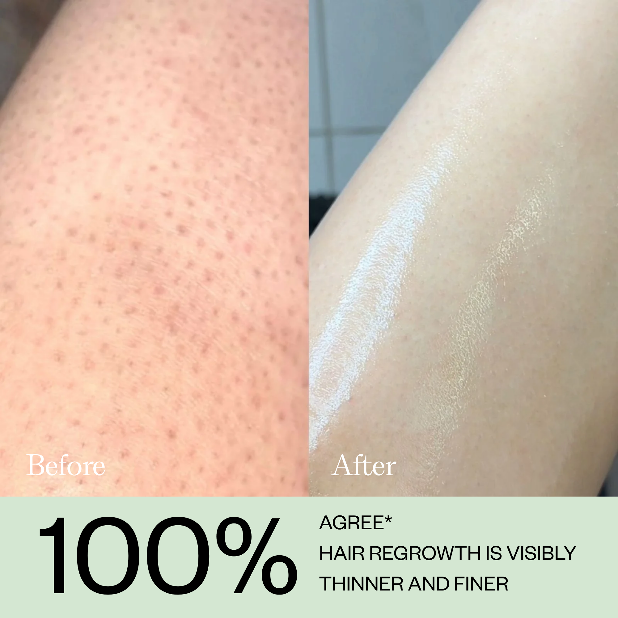 Hair Growth Inhibitor Serum