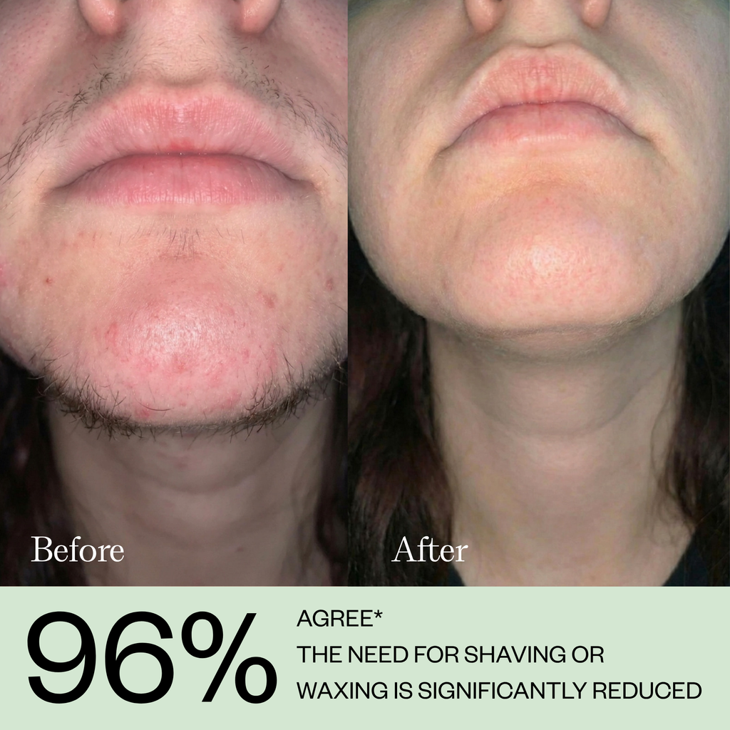 Hair Growth Inhibitor Serum